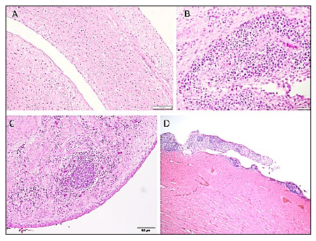 Figure 1.  A. Normal tendon. B. Predominantly lymphocyte and plasma cell populations in the synoviae. 40X C. Development of a lymphoid nodule within the gastrocnemius tendon. 20X D. Heart. Multiple lymphoid nodules over the epicardium. H&E stain.