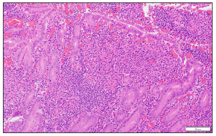 Figure 1. Goat, small intestine. Aggregates of macrophages are present in the villus lamina propria.  H&E stain.