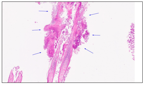 Figure 2. Rainbow trout fish with cutaneous ulceration along the lateral body wall, characteristic of columnaris disease (arrow). 