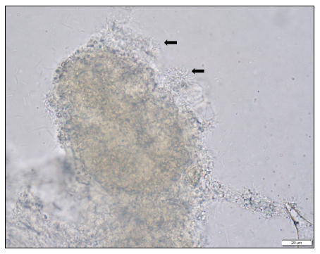 Figure 1. Wet mount cytology from the skin of a rainbow trout affected with columnaris disease exhibiting column-like stacked mats of slender filamentous bacteria (arrows).