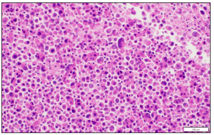 Figure 2. Canine, spinal meninges. Neoplastic histiocytic cells with atypia (variation in nuclear shape, size, and number). H&E stain.