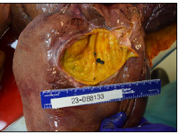 Figure 2. Porcine (pig) gall bladder