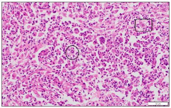  High magnification histologic view of the mammary tissue showing fungal organisms (inside black outlines) in a background of severe pyogranulomatous inflammation. One of the fungi is undergoing budding (black rectangle). H&E stain.