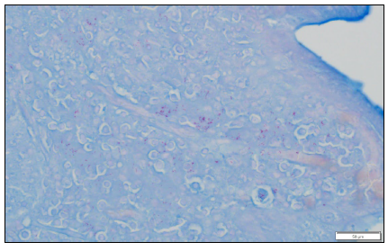 Figure 2. Goat, small intestine. Modified acid fast-positive bacteria are present in the cytoplasm of macrophages.