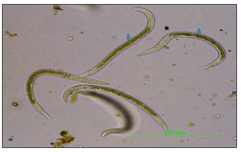 Figure 2. L1 of Dictyocaulus viviparus shows dark food granules in the intestinal cells.