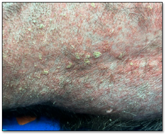 Figure 1. Sarcoptic mange. Erythema with crusts and multifocal dried pustules on the  ventral abdomen