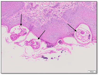 Figure 2. Histologic section of the skin. Embedded in the stratum corneum of the epidermis  are several Sarcoptes scabiei mites (arrows). H&E stain.