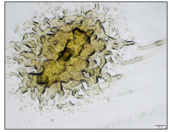 Figure 5. Bacterial culture plate morphology of a F. columnare colony exhibiting characteristic flat rhizoid structure with irregular margins. Also note the characteristic yellow pigmentation of the colony that can also afford yellow tissue discolouration in affected fish.