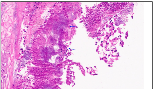 Figure 4. Higher magnification of the gill with necrotic debris being widely permeated by a dense meshwork of filamentous bacteria (arrows). H&E stain.   