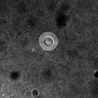 Capsule production of Cryptococcus neoformans H99 strain under iron limited conditions by differential interreference microscopy.