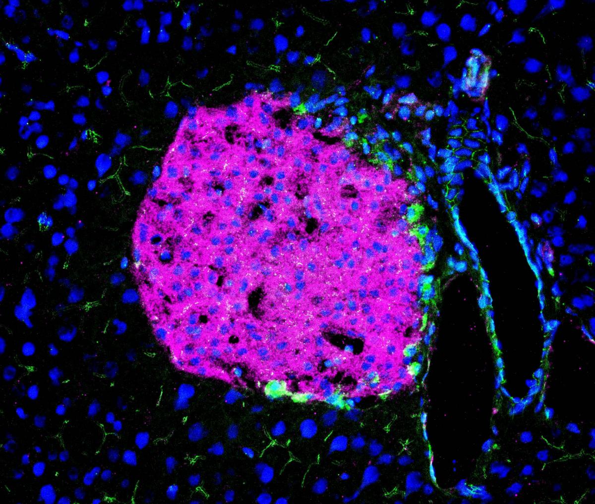 pancreatic islet