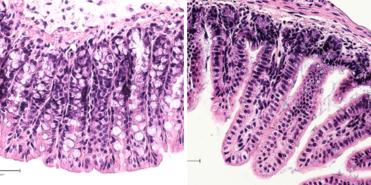 cross-section of colon and small intestine