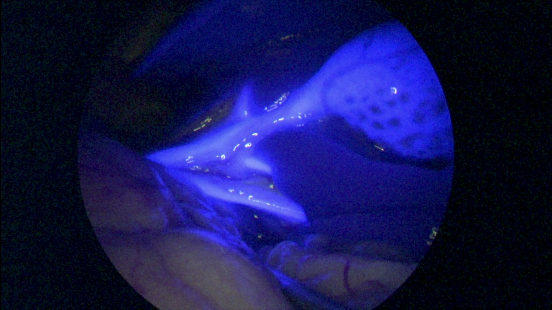 Inside a dog’s abdomen, a fluorescent blue gall bladder and biliary tree is seen against a dark and undistinguishable liver and fat background. 