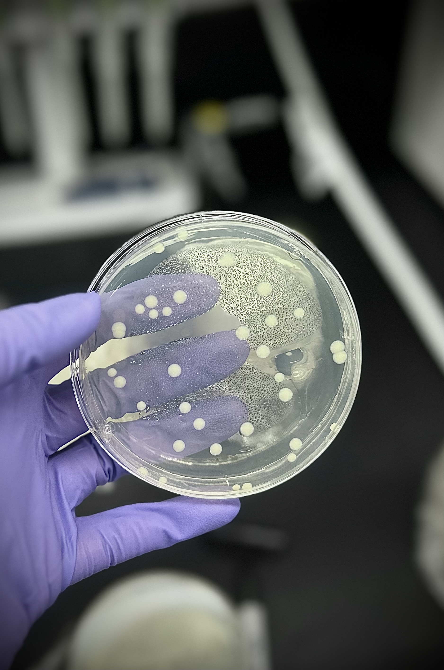 A hand in a purple glove holding a petri dish with salmonella in it.