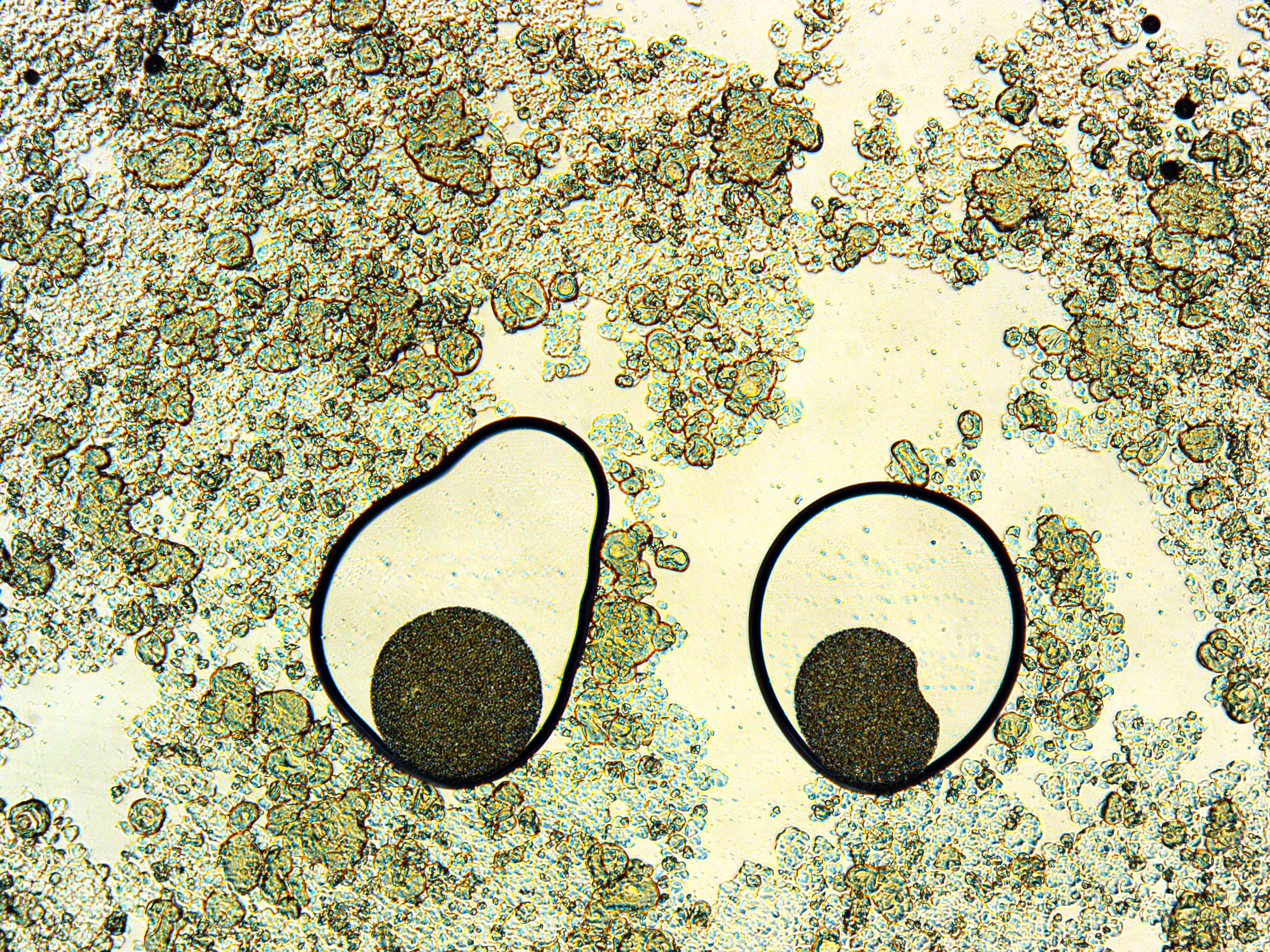 Microscope sample with small pieces of protein and starch, shaped like eyes. 