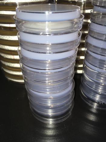 Multiple agar plates with a white one in front of the others