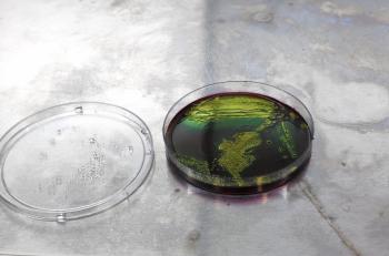 A vibrant greenish colony of E. coli in a dish on a surface.