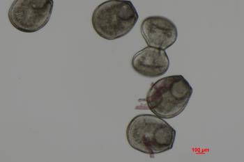 Five freshwater mussels larvae