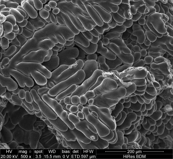 The dendritic microstructure of an Al-Si alloy viewed under a scanning electron microscope (SEM).