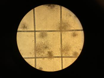 A yellow circle with darker cell colonies throughout it