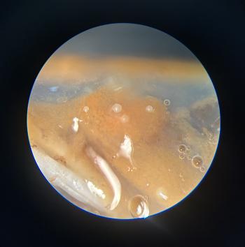 Small pearls found within the tissues of a dissected blue mussel under a microscope