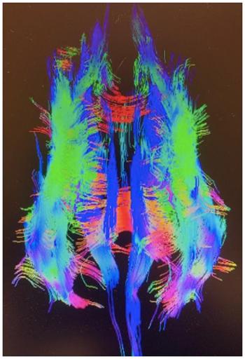 An MRI of a dog brain with vibrant neon blues, pinks, greens and reds representing parts of the brain.